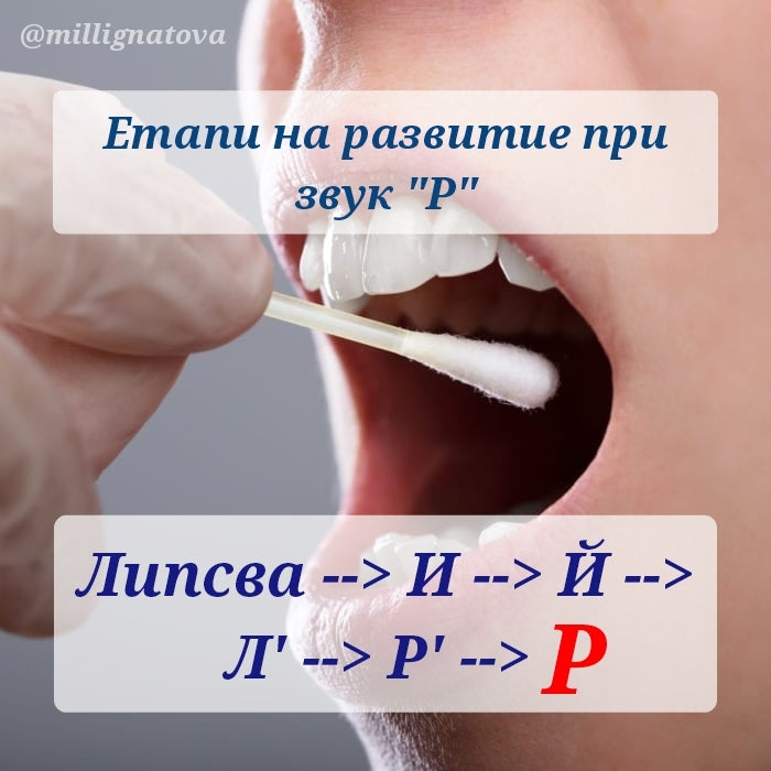 ΠΡΠ°ΠΏΠΈ Π½Π° ΡΠ°Π·Π²ΠΈΡΠΈΠ΅ Π½Π° Π·Π²ΡΠΊ "Π "